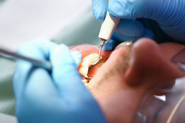 Best Dentist for Tooth Abscess  in South Ack, NY