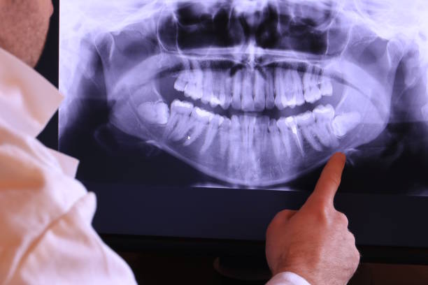 Urgent Tooth Repair in NY